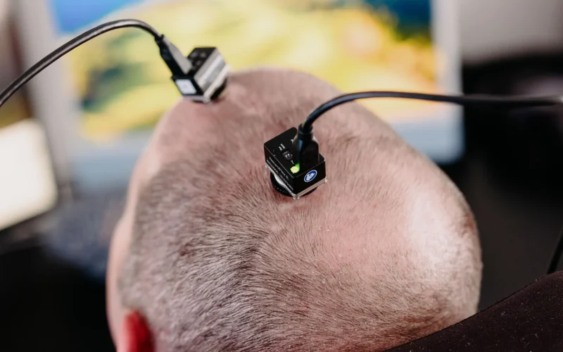 Implante Cerebral Revoluciona Comunicação para Pacientes com Esclerose Lateral Amiotrófica: O Poder da Tecnologia
