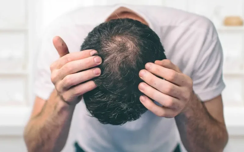 Estresse Acelera Queda de Cabelo: Entenda o Impacto e a Solução Científica com Cafeína